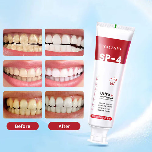 SP4 Oral Care Probiotic Whitening Toothpaste 120g – Shine Brighter, Remove Years of Coffee, Tea & Smoking Stains