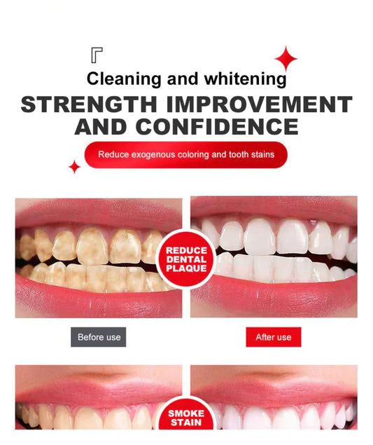 SP4 Oral Care Probiotic Whitening Toothpaste 120g – Shine Brighter, Remove Years of Coffee, Tea & Smoking Stains